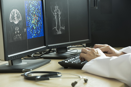 Doctor using computer to analyze MRI brain picture in radiology room of the hospitalの写真素材