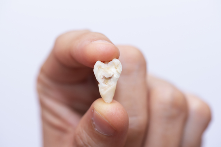 A person using finger to hold a half of extracted wisdom tooth stained on white backgroundの写真素材