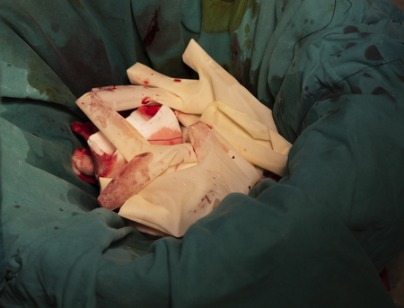 Used surgical gloves, gauzes and silk in a garbage bin for biohazard disposalの写真素材