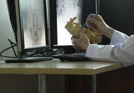 Doctor use a pen to demonstrate the anatomy of human lumbar spine model in medical officeの写真素材