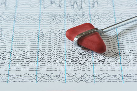 Reflex hammer on background of human brain waves from electroencephalogram