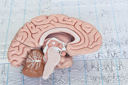 Human brain model on background of brain waves from electroencephalographyの写真素材