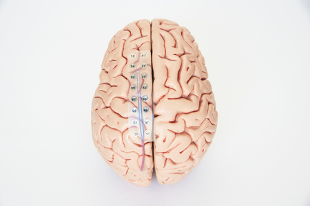 Subdural grid electrode for brain waves recording or electroencephalography on the artificial brain model cortexの写真素材