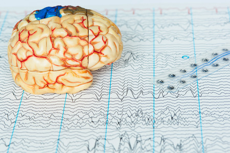 Human brain model and subdural electrode recording brain waves on background of brain waves from electroencephalographyの写真素材