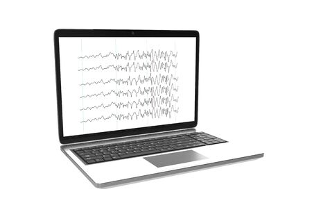 A laptop with screen display of epileptic seizure electroencephalograhy isolated on white background. 3D rendering.の写真素材