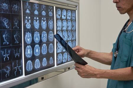Doctor looking at MRI film of human brain in operating roomの写真素材
