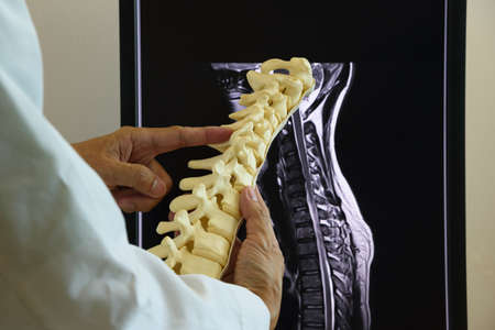 Doctor holding cervical spine model in front of MRI spine computer screen