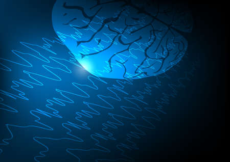 Vector illustration of human brain and abnormal brain waves waves representing focal seizure