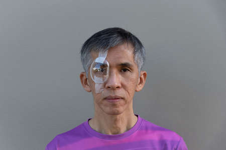 An Asian senior adult male with right plastic clear protective shield after cataract surgery.