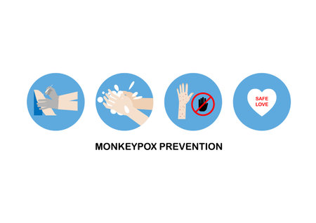 Concept of monkeypox prevention. Hand wash, vaccination, do not touch skin lesions, safe sex. Vector illustration.のイラスト素材