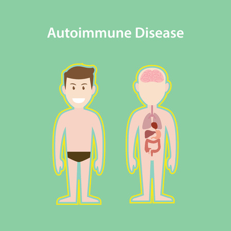 autoimmune disease system illustration with cartoon human man body with protection effect vectorのイラスト素材