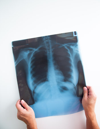 Medical doctor hand holding a x ray image. Medical Concept