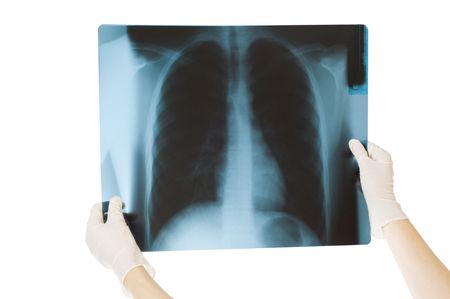 Doctor examining x-ray scans isolated on a white background