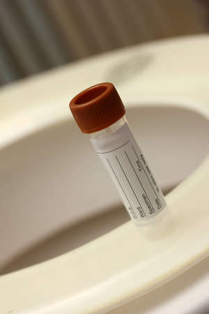 medicinical stool sampleの写真素材