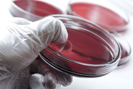red laboratory petrischalen