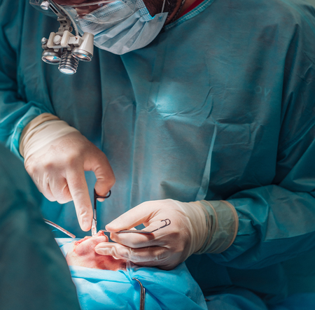 Cosmetic surgery on nose. The surgeon cuts the fleshの写真素材