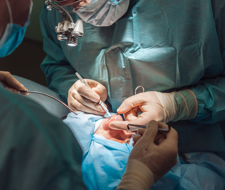 Cosmetic surgery on nose. The surgeon cuts the fleshの写真素材