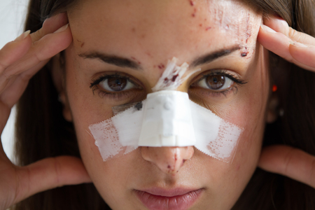 girl victim of accident or violenceの写真素材