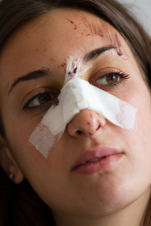 girl victim of accident or violenceの写真素材