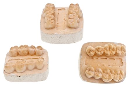 Plaster mould for manufacturing artificial teeth