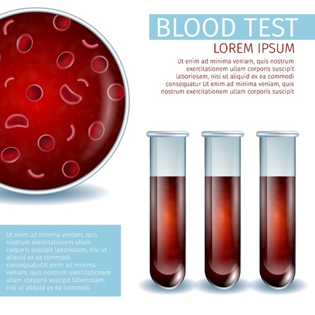 Macro View of Red Erythrocyte Cell with Hemoglobin Inside and Set of Laboratory Glass Tubes with Liquid Blood Samples. Realistic Vector Illustration. Square Hematology Medical Banner with Copy Space.のイラスト素材