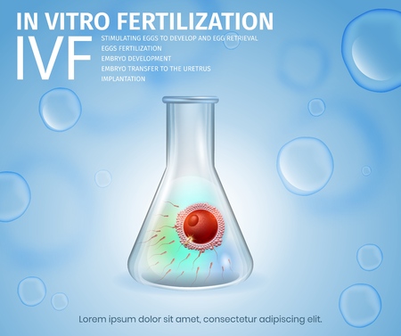In Vitro Fertilization Process. Female Egg and Sperm Union Inside of Glass Beaker. Spermatozoons and Woman Cell in Test Tube. Reproductive System Technology. IVF. Vector Realistic Illustration. Bannerのイラスト素材