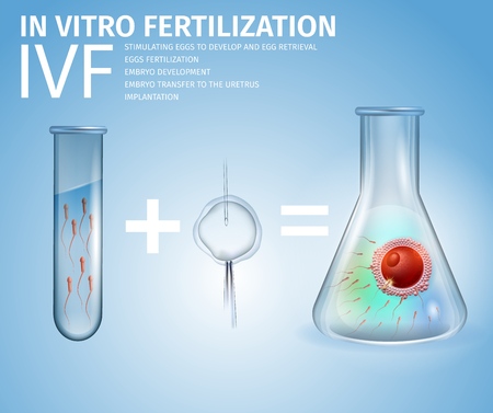 In Vitro Fertilization Formula. Male Sperm in Test Tube Plus Prepared Female Egg Cell Equally Embryo in Beaker on Blue Gradient Background. IVF Stages. Vector Realistic Illustration. Medical Bannerのイラスト素材