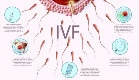 Microscopic Research View of In Vitro Fertilization Process Close Up. Laboratory Equipment and Stages of IVF Icons. Vector Realistic Illustration. Human Reproductive Medicine Banner with Copy Space.のイラスト素材