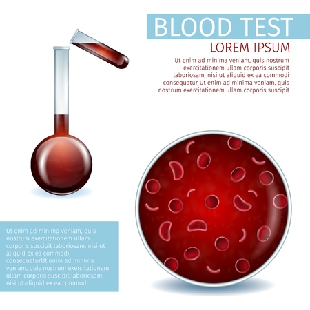 Blood Test. Hematology Medical Banner. Close Up View of Red Erythrocyte Cell and Blood Pouring from Test Tube to Beaker. Visual Material Aid for Clinic Use. Realistic Vector Illustration. Copy Space.のイラスト素材