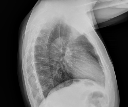 Medical X-raysの写真素材