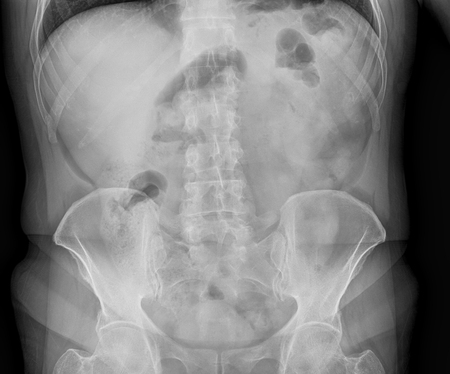 Medical X-rays