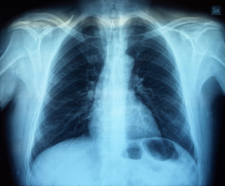 Medical X ray imaging of human bonesの写真素材
