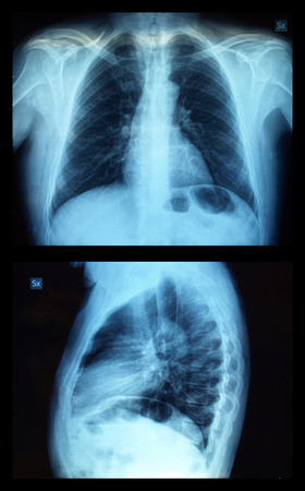Medical X ray imaging of human bonesの写真素材