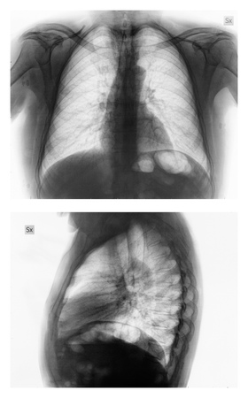 Medical X ray imaging of human bonesの写真素材