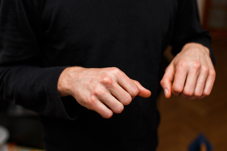 The problem with many people - eczema on hand. Man in black itchind skin.の写真素材