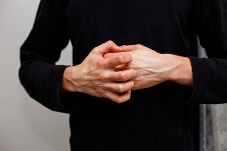 Man scratch oneself, dry flaky skin on hand with psoriasis vulgaris, eczema and other skin conditions like fungus, plaque, rash and patches. Autoimmune genetic disease.の写真素材