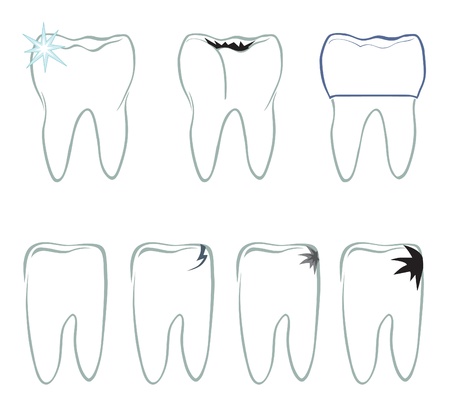 Tooth  set  Dental symbols set のイラスト素材