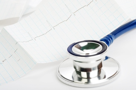 A part of blue stethoscope on a cardiogramの写真素材