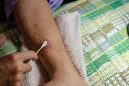 A daughter is treating her father's wound from a sock tie.