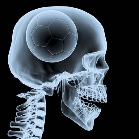 Big match never die, ball in headの写真素材