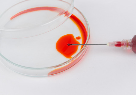 Syring extracting sample from petri dishの写真素材