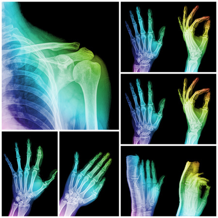 Collage of many X-rays. Very good quality