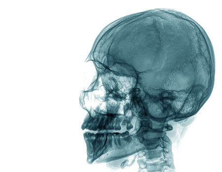 X-ray of a human skullの写真素材