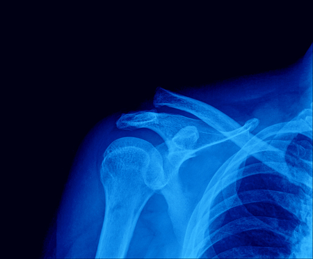 X-ray of shoulder joint / Many others X-ray images in my portfolio.