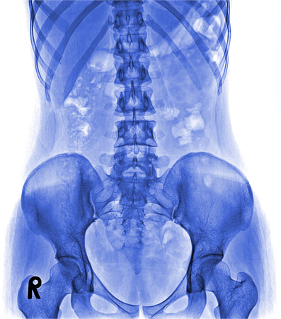 X-ray lumbo-sacral spine and pelvisの写真素材