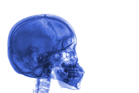 skull x-rays image sagital planeの写真素材