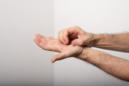 Middle aged man scratching his hand. Skin disease. Allergic reaction. Dermatological careの写真素材