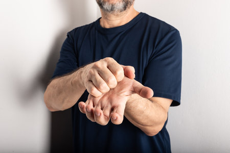 Middle aged man scratching his hand. Skin disease. Allergic reaction. Dermatological careの写真素材