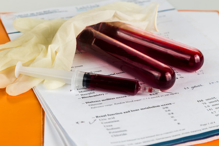 Blood sample in test tubes with health analysis screening report.の写真素材