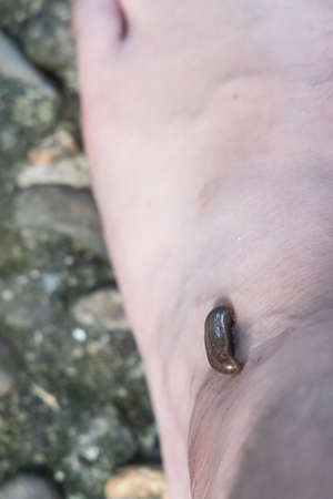 Closeup of leech attach biting on leg foot in tropical forrestの写真素材